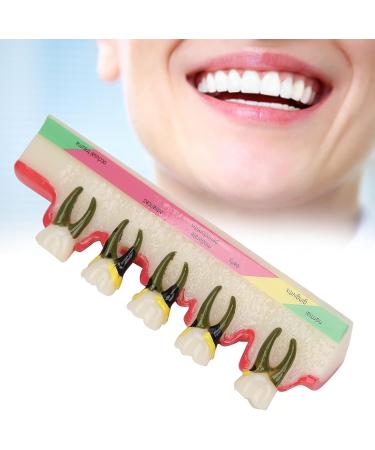 Shop Verdant Touch Tooth Model - Dental Periodontal Disease Study Tool for Schools | International Shipping Available - Buy Online on GoSupps.com