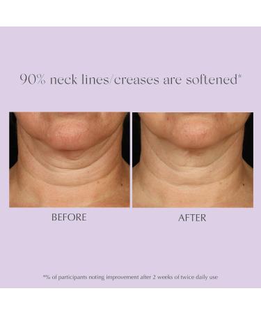 Buy EXUVIANCE AGE REVERSE+ Neck Cream - Anti-Aging Moisturizer for Firming Toning & Wrinkle Reduction 4.4 oz - Shop Internationally - Buy Online on GoSupps.com