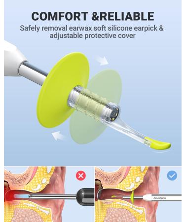 AnyScope Digital Otoscope with Gyroscope HD Ear Camera with Ear Wax Removal Tools Video Ear Scope Otoscope with Light Compatible with iPhone and Android (Silver) - Buy Online on GoSupps.com
