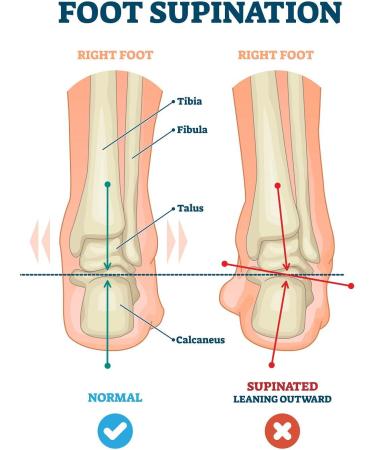 Pedag Correct Plus Wedge Insoles | German Manual Work 3/4 Length Orthopedic Footbed Vegetable Tanned Leather Size 37-40 EU | Comfort for Overpronators - Buy Online on GoSupps.com