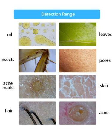 Skin Diagnosis Hair Analyzer 10.1inch Screen Multi Functional High Definition Rechargeable Skin Scalp Hair Follicle Detector High Sensitivity Digital Hair Follicle Skin Analyser Machine - Buy Online on GoSupps.com