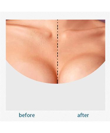 VolksRose Face & Chest Wrinkle Patches Reusable Silicone Patches for Brow Lift Wrinkle Smoothers Cleavage - Overnight Anti-wrinkle Face Tape Mask Smoothing Pads for Anti-wrinkles 3 Patches incl T-Shaped Decollete Pad - Buy Online on GoSupps.com