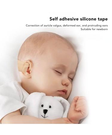 Anggrek Baby Auricle Valgus Correction Patch - Professional Silicone Infant Ear Aesthetic Corrector - Buy Online on GoSupps.com