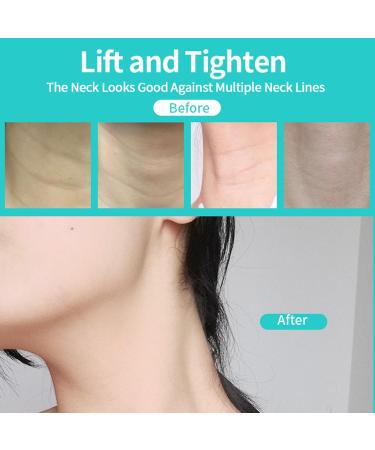 24 Pcs Neck Lift Tape Neck Tape Lifting Invisible for Face Jaw Necks Instant Necks and Face Lift Strap Patch Tightening Tapes (4 Skin Tone Bands + 20 Replacement Tapes) 4pcs Skin Color - Buy Online on GoSupps.com