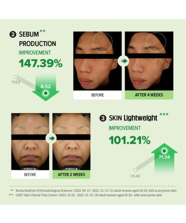 O'LABS Blemish Care Serum 30ml / 1.01 fl.oz Lightweight Facial Serum Vitamin C Stevia Water Base - Buy Online on GoSupps.com