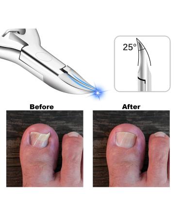 Professional Podiatrist Toenail Clippers for Ingrown & Thick Nails | Safety Lock, Wooden Handle | Large Size - Buy Online on GoSupps.com