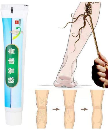 Varicose Veins Cream & Ointment for Relief | Phlebitis Angiitis & Inflammation Treatment - Buy Online on GoSupps.com