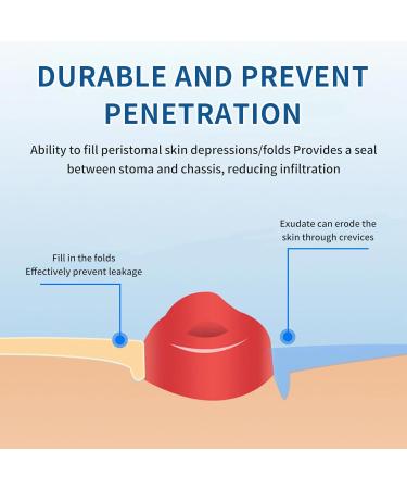 Ostomy Medical Supplies - Barrier Rings for Better Seal | Stoma Rings - 2” Outer Diameter 4mm Thickness - Box of 10 - Buy Online on GoSupps.com