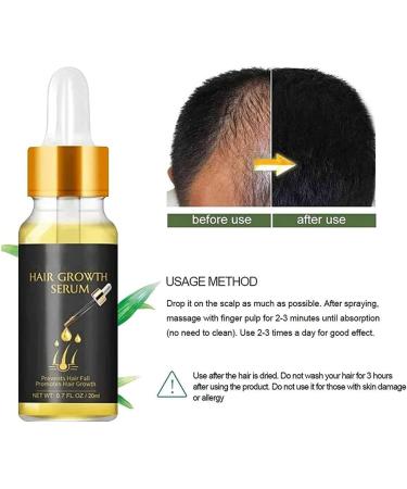 Hair Growth Oil Strong Hair Regrowth Serum Organic Hair Regrowth Kit Ginger Germinal Oil For Thicker Stronger Healthier Hair - Buy Online on GoSupps.com