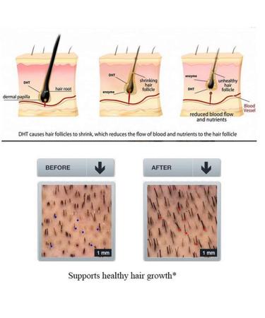 Ginger Hair Growth Shampoo & Conditioner Set | Nature Nourishing Care for Thicker, Longer Hair | Stimulates Growth & Reduces Hair Loss - Buy Online on GoSupps.com