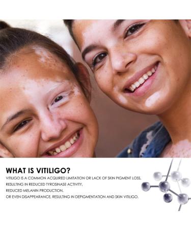 Kolmax Alkyne Psoriasis and Vitiligo Relief Spray - Reduces White Spots on Skin - 3PCS - Buy Online on GoSupps.com