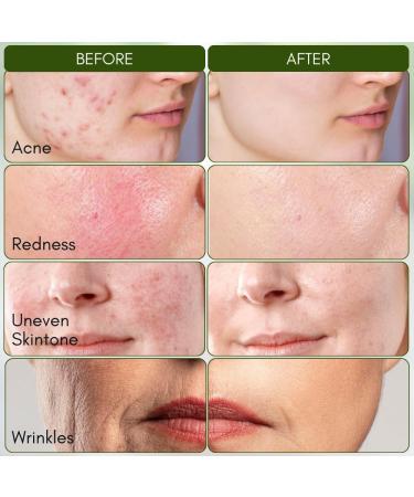 7 Color LED Face Mask | Red & Blue Light Therapy for Skincare | Cordless Wireless Facial Mask for Home & Travel - Buy Online on GoSupps.com