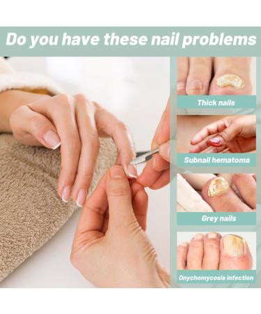 2 pi ces Stylo de Soin des Ongles+vernis poderm mycose ongle pied Traitement Mycose Ongle des Pied Puissant R paration Des Ongles Renforce et Revitalise Les Ongles Huile De Th ier et Romarin - Buy Online on GoSupps.com