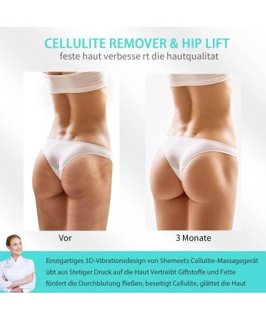 Anti-Cellulite Massage Device | Electrical Lymph Drainage with 3 Washable Pads for Belly Legs & Arms - Buy Online on GoSupps.com