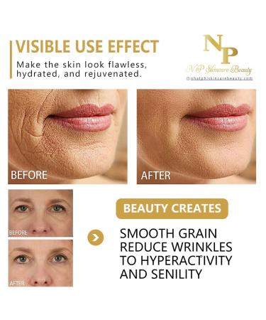 NP Skincare Instant Lift Cream - Vitamin C Argireline & Plant Stem Cells for Youthful Skin | Reduces Wrinkles Puffiness & Dark Circles - 50g - Buy Online on GoSupps.com