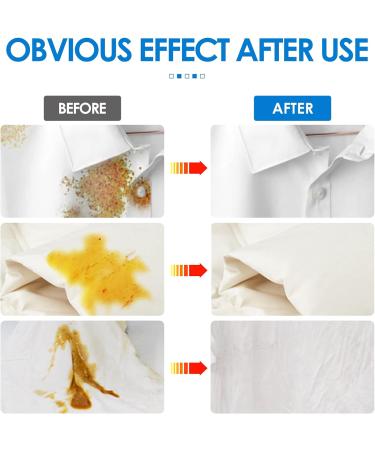 Clothes Stain Remover-Roll Bead Design Magic Stain Remover Rolling Bead Ideal for Emergency Stain Removal Portable No-wash Instant Stain Remover Pen Stain Remover Roller-Ball Cleaner - Buy Online on GoSupps.com