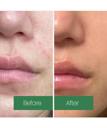 LAPALETTE Calming Green Turnover Toner | Green Tea | Hydrating & Moisturizing | Gentle Peeling with Natural Aha Bha & PHA Ingredients | Red Irritated Skin | Vegan | Korean Skincare 6.75fl.oz - Buy Online on GoSupps.com