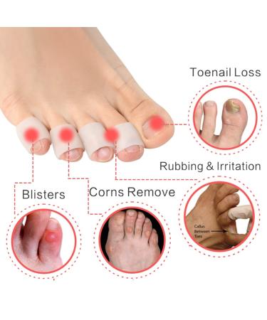 Gel Toe Protectors 20 PCS - Open Toe Sleeves for Pinky Toe - Bunion, Blisters, Corns, Hammer Toes - Toe Tubes for Friction Pain Relief - New Material - Toe Caps for Toenails Loss - Toe Sleeves for Pinky Toe - 20pcs - Buy Online on GoSupps.com