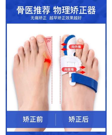 Big Toe Corrector for Thumb Valgus - Effective Toe Alignment Support - Buy Online on GoSupps.com