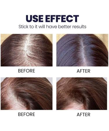 TANGERINE Blusoms Hair Growth Serum Spray with Ashwagandha - Pack of 5 - Buy Online on GoSupps.com