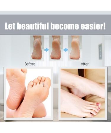 Amope Pedi Perfect Extra Coarse Roller Refills with Diamond Crystals - 6 Count - Buy Online on GoSupps.com