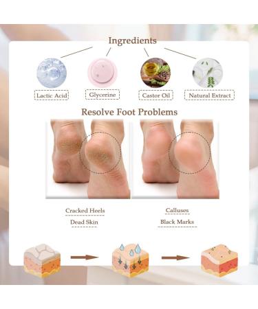 SKINPURE Advanced Exfoliation Peeling Foot Mask (Coconut) Removes Dead Skin Dry Cracked Feet and Calluses - Foot Spa Treatment at Home - Best Gift for Women and Men - Buy Online on GoSupps.com