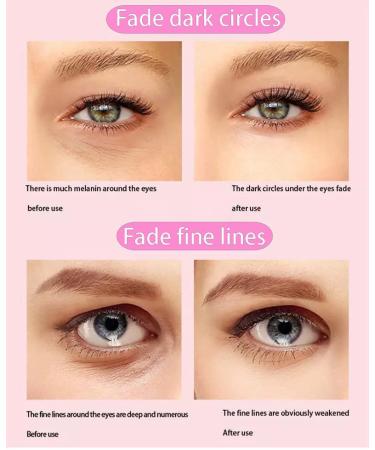 Sky Bliss Face Wand | Anti Aging Skin Care Device | Red Light Therapy & Microcurrent Tool | Lifts, Firms, & Reduces Wrinkles | Face & Neck Massager (Pink) - Buy Online on GoSupps.com