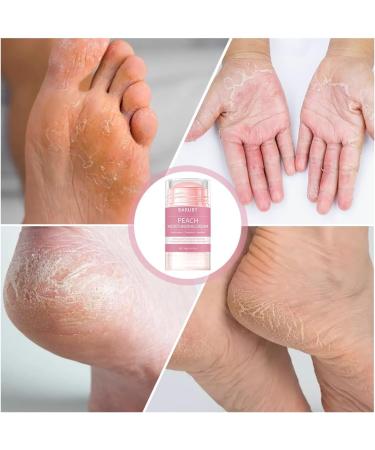 Foreverup Focusing and antiracking foot cream hydrating and antiracking creams ureum foot cream creams for cracked heavily and dry skin - Buy Online on GoSupps.com