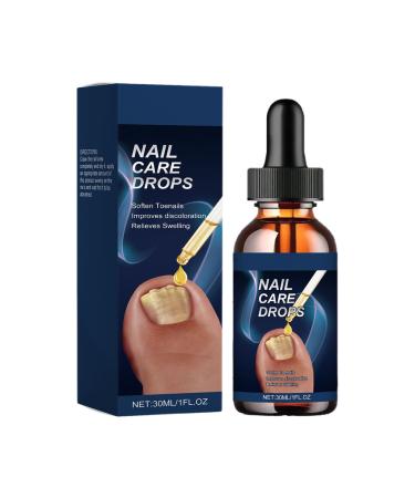 Ingrown Toenail Soother | 15ml Gentle Nourishing Solution | Strengthening Nail Drops for Dryness Redness Thickening and Nail Care for Women and Men - Home Manicure Salon Pedicure Preparation