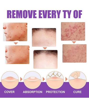 Skin Tag Removal Solution.(2PC 30ML) 2PC 30ml - Buy Online on GoSupps.com