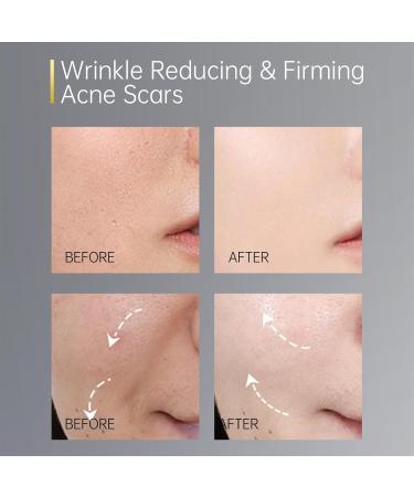7 Day Type I & III Collagen Face Serums Anti-Aging Wrinkle Daily Line Smoothing Skin Care Treatment for Fine Lines Post-Acne Scars | 3% Squalane + jojoba oil 7 Individual Capsules Floral 7 Capsules - Buy Online on GoSupps.com