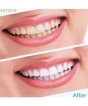 Fast & Painless 28 White Strips Teeth Whitening Kit - Home Bleaching for Bright Smiles - Buy Online on GoSupps.com