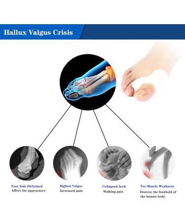 Silicone Toe Separators - 4 PCS Bunion Corrector for Men and Women - Restore Big Toes to Original Size - White 3 - Buy Online on GoSupps.com