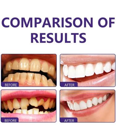 Teeth Repairing Foam & Whitening Mouthwash - Eliminate Bad Breath & Prevent Cavities (2 Pack) - Buy Online on GoSupps.com