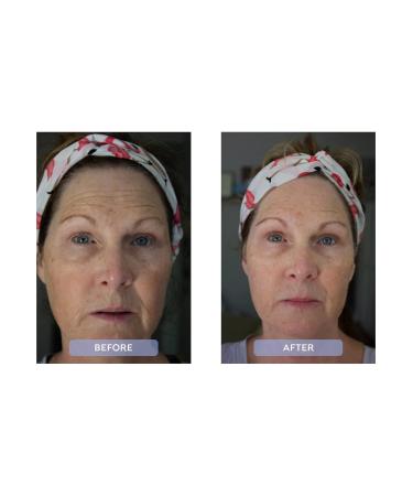 Dr. Zenovia Hormonal Dermatology Peptide + Ceramide Moisturizer | Hydrating Face Cream with Hyaluronic Acid for Women's Skin Repair - Buy Online on GoSupps.com