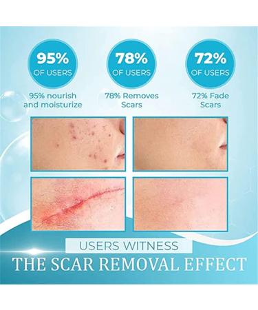HADAVAKA Organic Scar Removal Gel for Man and WomanOrganic Scar Removal Gel Scar Removal Cream Scar Removal of Old and New Scars - Buy Online on GoSupps.com