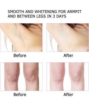 Korean Skin Care Kojic Acid Skin Cream Underarm Cream For Intimate Area Private Parts Knees Elbows Inner Thigh Bikini Areas Cream Quickly Absorb & Reduce Odor Smoothing. - Buy Online on GoSupps.com