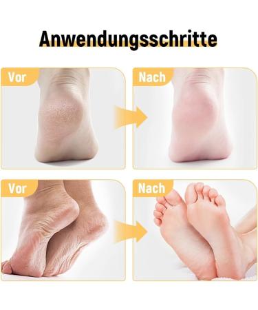 60% Urea Cream Pieds R paratrice Hydratante Cr me l'Ur e Heel Pain Ointment Pour Relief Cr me Pieds Tr s Secs Et Ab m s Pieds Tr s Secs Et Crevasse Cr me-Raffermissante-Corps 40g - Buy Online on GoSupps.com