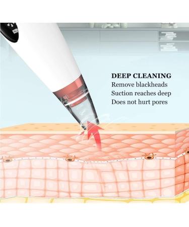 Sxdthy 3 Levels Adjustable Suction Blackhead Remover USB Rechargeable Blackhead Pore Cleaner Blackhead Suction Tool with HD LED Display & 6 Replaceable Heads - Buy Online on GoSupps.com
