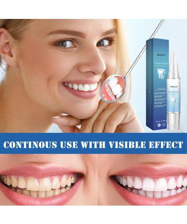 4ML Gum Shield Therapy Gel 2024 New Receding Gums treatments Instant Soothing Gel Gum Shield Therapy Gel for Deep Cleaning Stains and Tartar Oral Care#4ml - Buy Online on GoSupps.com