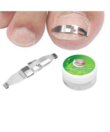 Ingrown Toenail Treatment Kit for Pain Relief - Paronychia Corrector Tool Set for Salon and Home Use - Buy Online on GoSupps.com