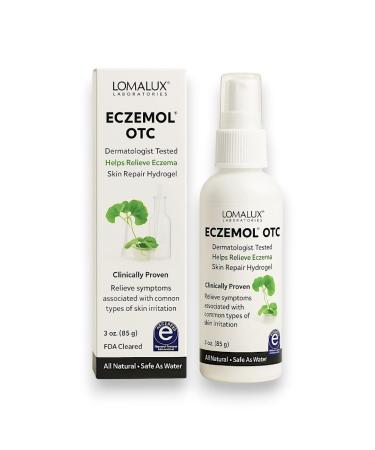 Loma Lux New Eczemol OTC Spray Natural & No Sting Hypochlorous for Eczema Wounds Burns Cuts Radiation Dermatitis Skin Irritation Sunburn Itchy Skin for Kids & Adults (8 Fl Oz.) Unflavored 8 Fl Oz.