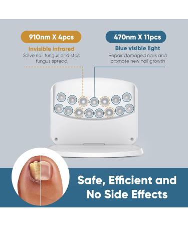Nail Fungus Light Device for Onychomycosis - Safe & Effective Home Use for Toenail & Fingernail Solutions - Buy Online on GoSupps.com
