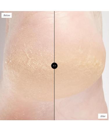 Beekman 1802 Sunshine Body Scrub - Fragrance Free 8 oz | Exfoliate Keratosis Pilaris | Gentle PHA Body Scrub for Sensitive Skin | Cruelty Free - Buy Online on GoSupps.com