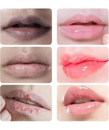  JIAOY JINSHANE Lip Serum Jinshane Lip Jinshane Lip Lightening Treatment Jinshane Treatment for Dark Lips Lip Fresh Treatment to Remove Dark Lips Moisturizing Lip Balm - Buy Online on GoSupps.com