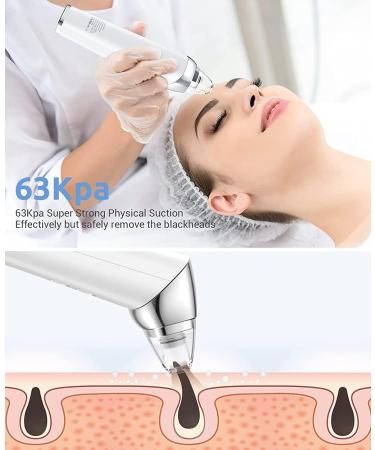 Blackhead Pore Vacuum Cleaner Remover | Upgraded 2023 Electric USB Rechargeable Extractor with 5 Probes | Blackhead Remover Kit for Women & Men - Buy Online on GoSupps.com