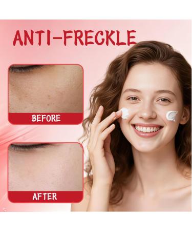 NHPY 2Pcs Cream Against Pigment SpotsPigment Spot Remover FaceFace Cream Women Age Spot RemovalDark Spot Improve Dull SkinAnti Freckles - Buy Online on GoSupps.com