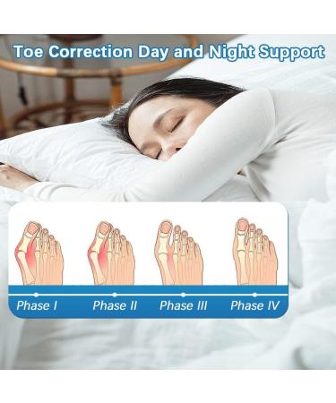 EITMOW Bunion Corrector for Women and Men - Orthopedic Bunion Toe Separators and Straightener for Day and Night Support - 2 Pair - Buy Online on GoSupps.com