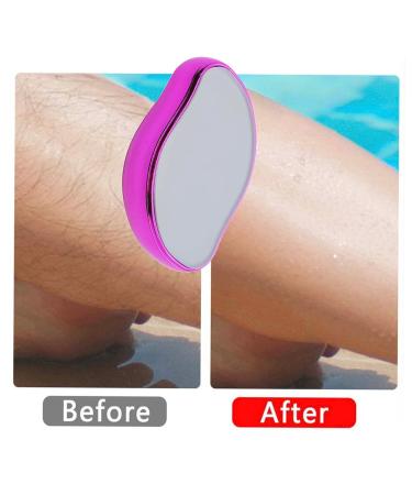 Crystal Hair Eraser - Painless Exfoliation Hair Removal Tool for Women and Men (Red/Rose) - Buy Online on GoSupps.com