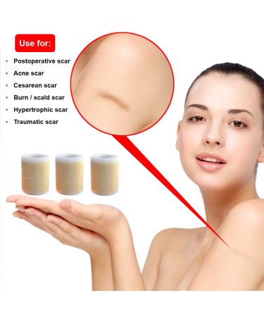 IGOOLEE Silicone Scar Sheets Strips Tape - 3 Reusable Rolls for Surgical Scar Removal - 1.57 x 120 Size - Ideal for Keloid & C-Section Scars - Buy Online on GoSupps.com